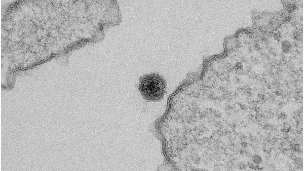 Virus brasiliano Yaravirus brasilenis